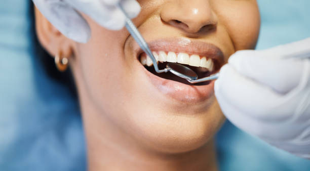 Best Chipped Tooth Repair Near Me  in Bangor, WI